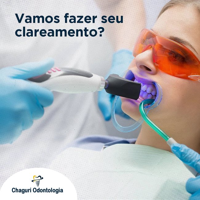VAMOS FAZER SEU CLAREAMENTO?