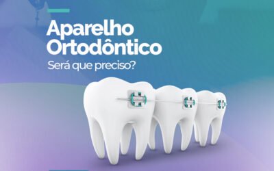 APARELHO ORTODÔNTICO SERÁ QUE PRECISO?