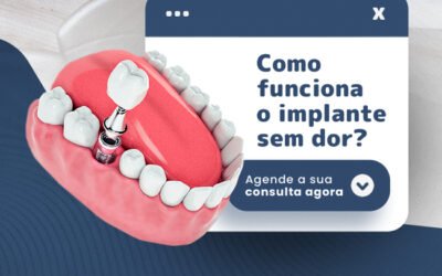 COMO FUNCIONA O IMPLANTE SEM DOR?