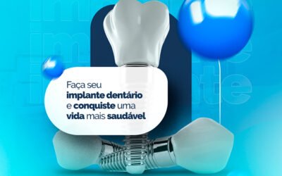 FAÇA SEU IMPLANTE DENTÁRIO