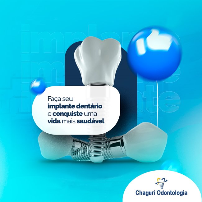 FAÇA SEU IMPLANTE DENTÁRIO