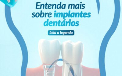 ENTENDA MAIS SOBRE IMPLANTES DENTÁRIOS
