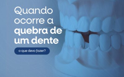 QUEBROU UM DENTE? SAIBA O QUE FAZER!
