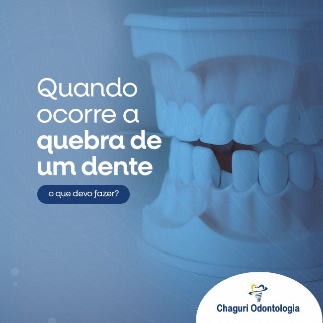 QUEBROU UM DENTE? SAIBA O QUE FAZER!